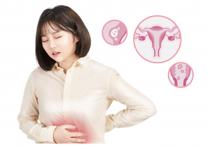 소중한 내 몸을 지키자! 여성건강 돌보기