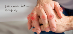 류마티스 관절염, 뻣뻣해지는 내 몸