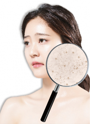 아, 기미 생길줄 알았으면 진작에 관리할걸…