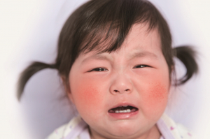 엄마 너무 가려워요… 우리아이 아토피 어떡하죠? 
