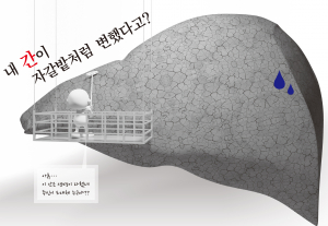 내 간이 자갈밭처럼 변했다?